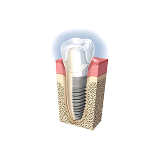 Orthodontics