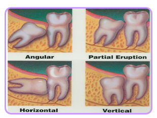 Orthodontics